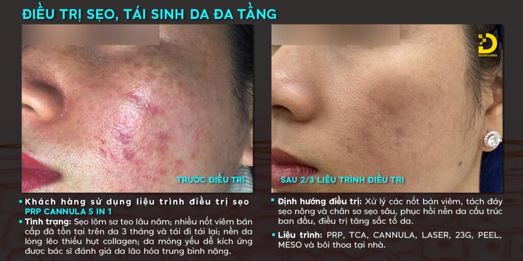 khach hang tri seo 5in1 doctor choice