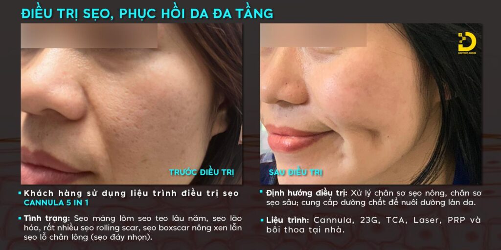 khach hang tri seo 5in1 dr choice
