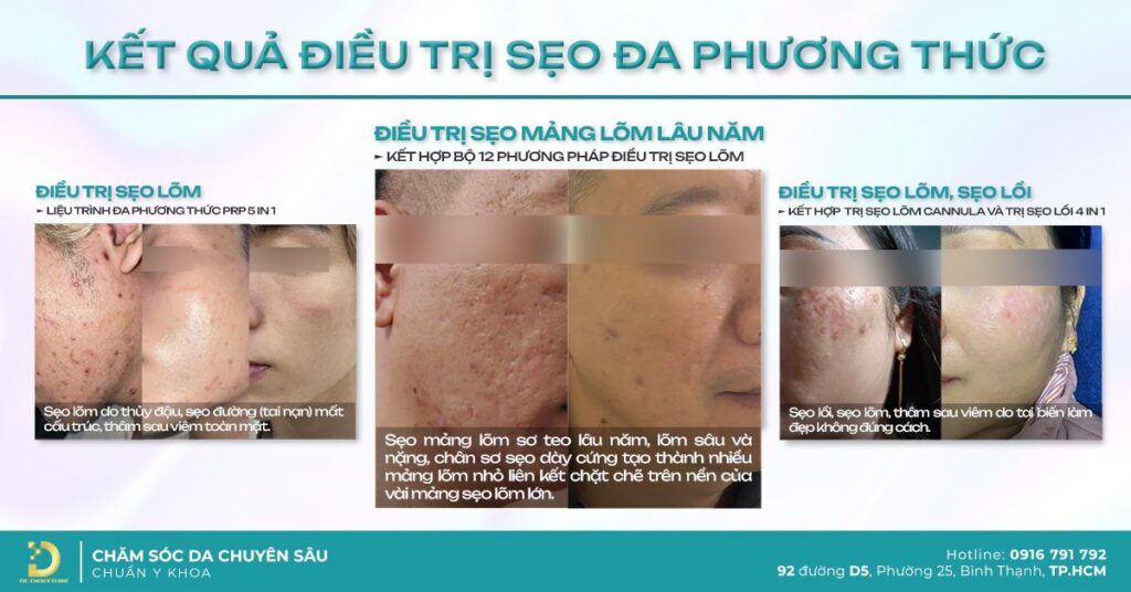 khach hang tri seo da phuong thuc dr choice