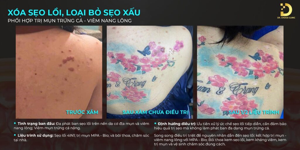 khach hang tri seo loi seo xau dr choice