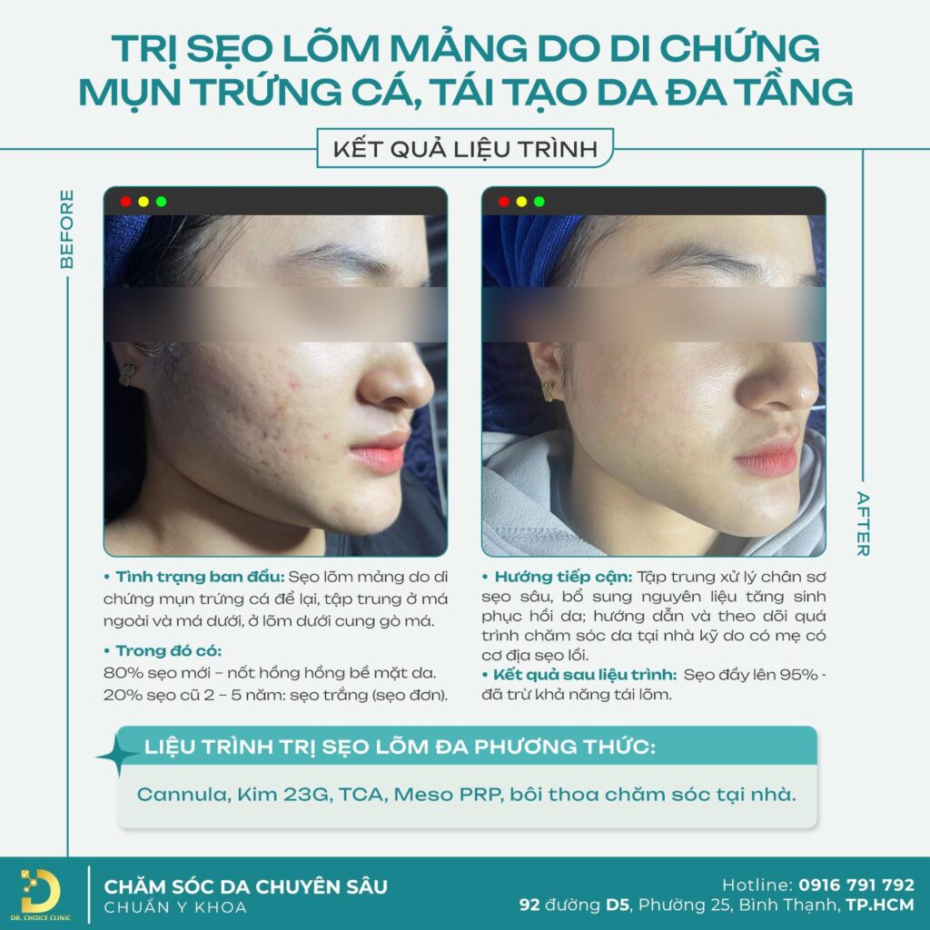 khach hang tri seo lom dr choice