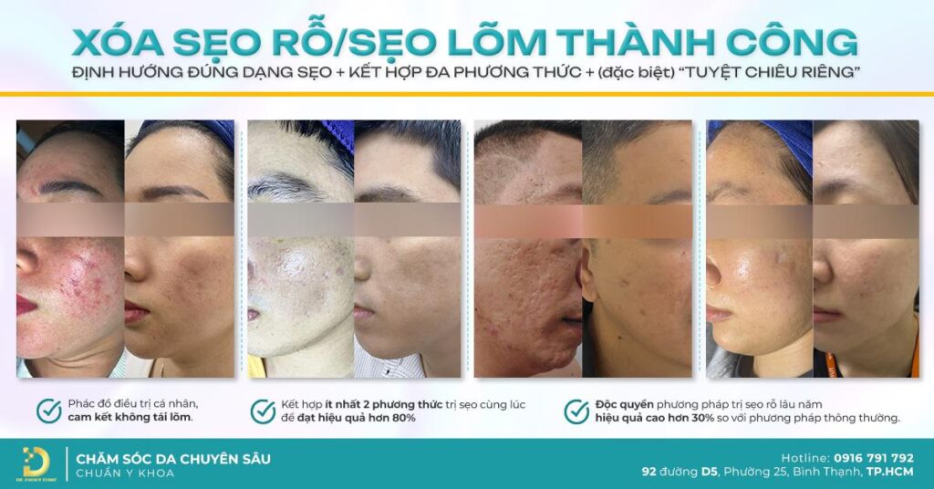 khach hang tri seo lom seo ro dr choice