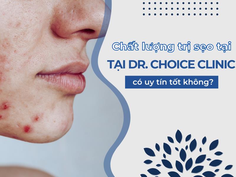 review dr choice