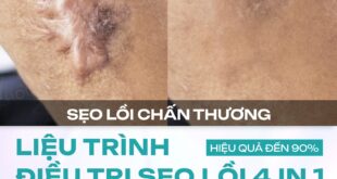 Dr. Choice Clinic: Hành trình “xóa dấu vết” sẹo lồi bằng liệu pháp 4IN1 độc quyền 